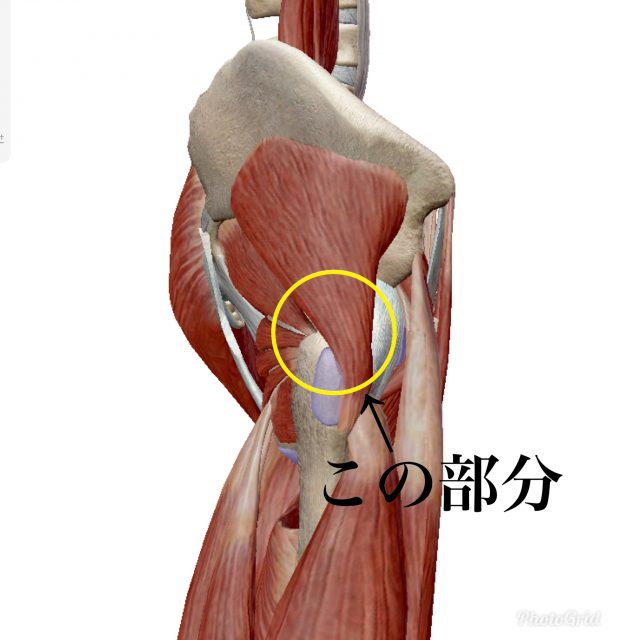 股関節痛 40代男性鍼灸治療症例報告 あま市医療従事者も通うフルミチ鍼灸院 自律神経失調症 腰痛専門院